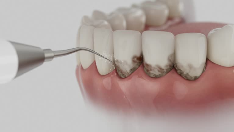 Reliable Dental Implants contractor in Chester, MD by Smile Center Dentistry